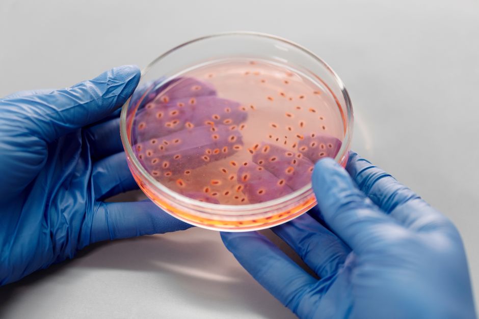 Microbial Genetics I (ND)