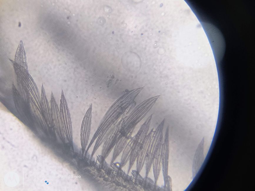 SIWES (Microbiology BSc)