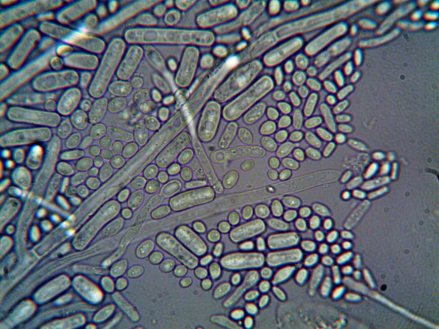 Thesis Defense (MSc Microbiology)