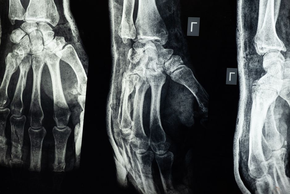 Anatomical Imaging & Radiological Sciences (MSc)