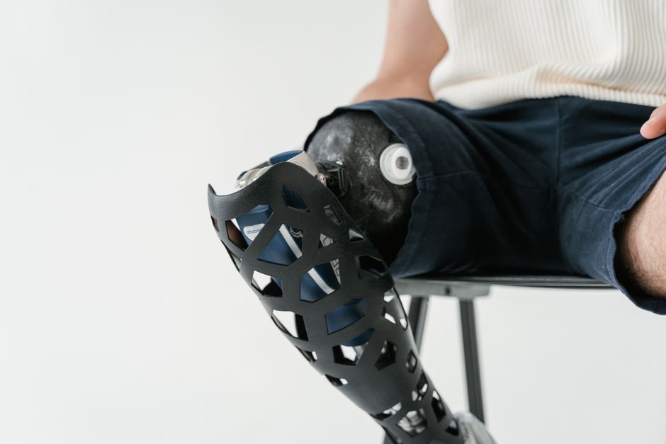 Introduction to Prosthetics & Orthotics